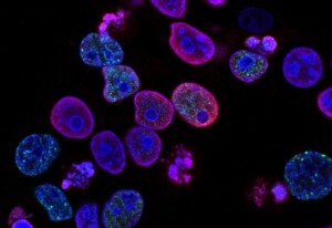 Bacteria Under a Microscope