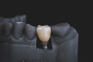 Tooth Resting in a Sculpture of a Jaw